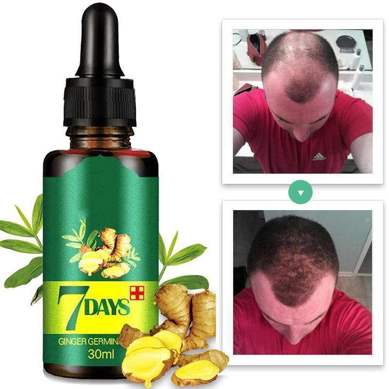 Ginger Hair Growth Essence