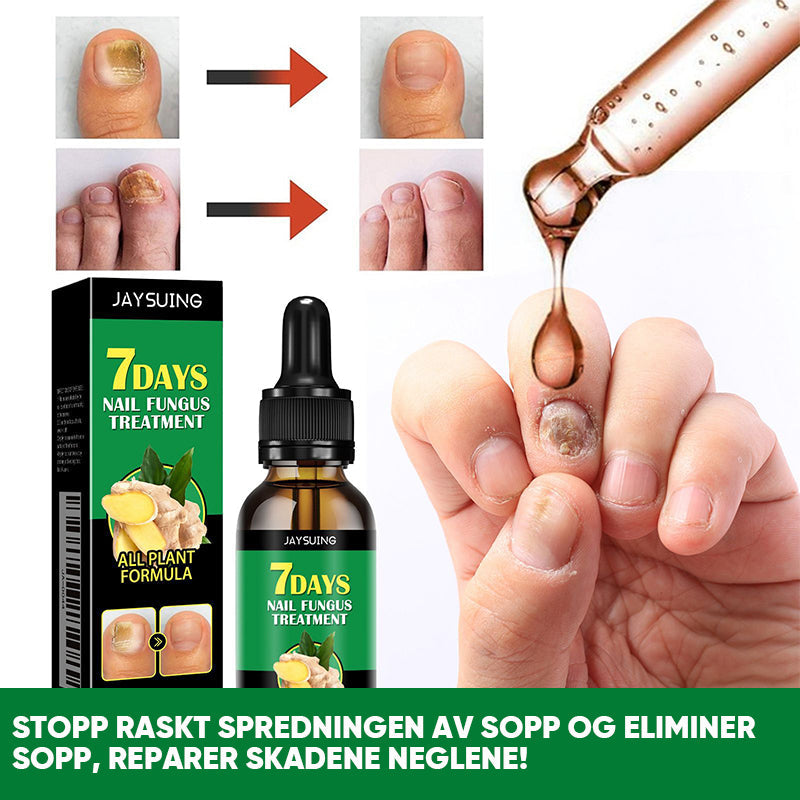 Ingefær Negle Behandling